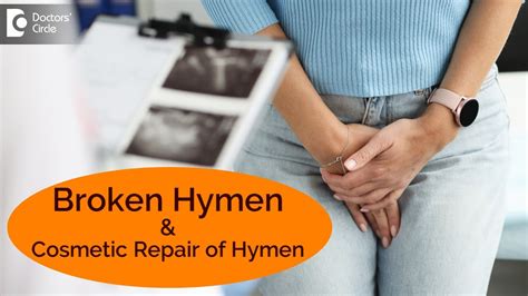 broken hymen|Hymen : Location, Pictures, Types, Repair Broken。